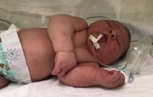 Inusitado: Bebê nasce com aproximadamente 5,2 quilos no Huop