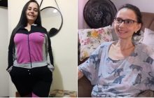 Mulher faz reversão de cirurgia bariátrica após chegar aos 36 kg e ter anemia extrema